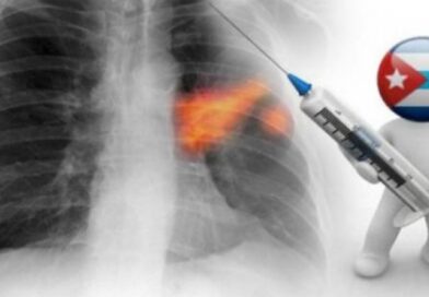 La estrategia de lucha contra el cáncer en Cuba (+video)