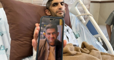 La historia del periodista palestino que volvió con el cráneo marcado La historia del periodista palestino que volvió con el cráneo marcado